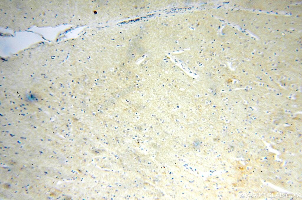 Immunohistochemistry (IHC) staining of human brain tissue using RIC8B Polyclonal antibody (17790-1-AP)