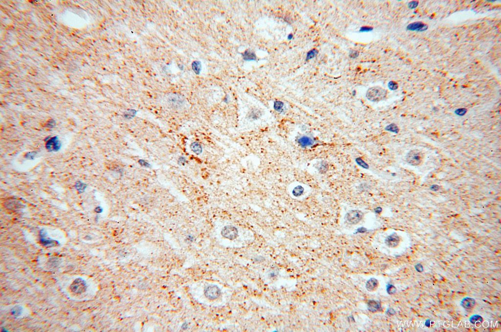 Immunohistochemistry (IHC) staining of human brain tissue using RIC8B Polyclonal antibody (17790-1-AP)