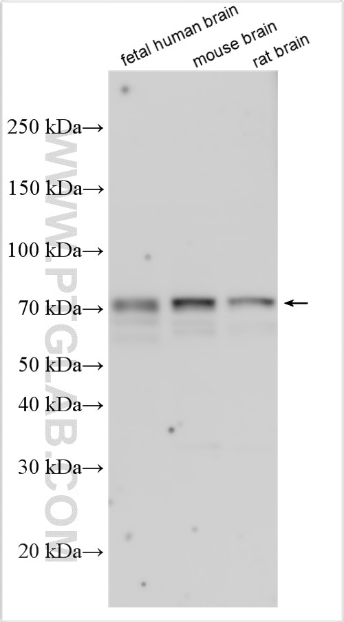 Western Blot (WB) analysis of various lysates using RIC8B Polyclonal antibody (17790-1-AP)