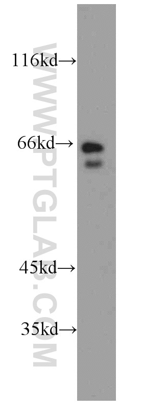 Western Blot (WB) analysis of human brain tissue using RIC8B Polyclonal antibody (17790-1-AP)