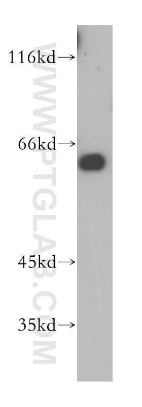 Western Blot (WB) analysis of human brain tissue using RIC8B Polyclonal antibody (17790-1-AP)