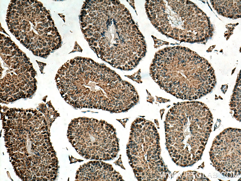 Immunohistochemistry (IHC) staining of mouse testis tissue using ARHGAP32 Polyclonal antibody (15024-1-AP)