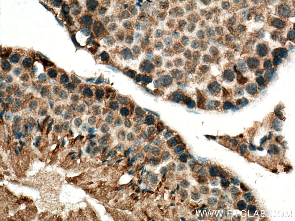 Immunohistochemistry (IHC) staining of mouse testis tissue using ARHGAP32 Polyclonal antibody (15024-1-AP)