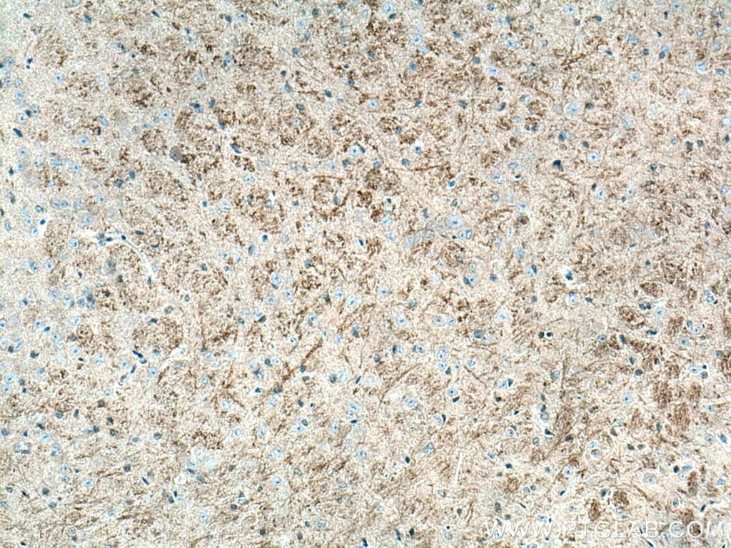 Immunohistochemistry (IHC) staining of mouse brain tissue using ARHGAP32 Polyclonal antibody (15024-1-AP)