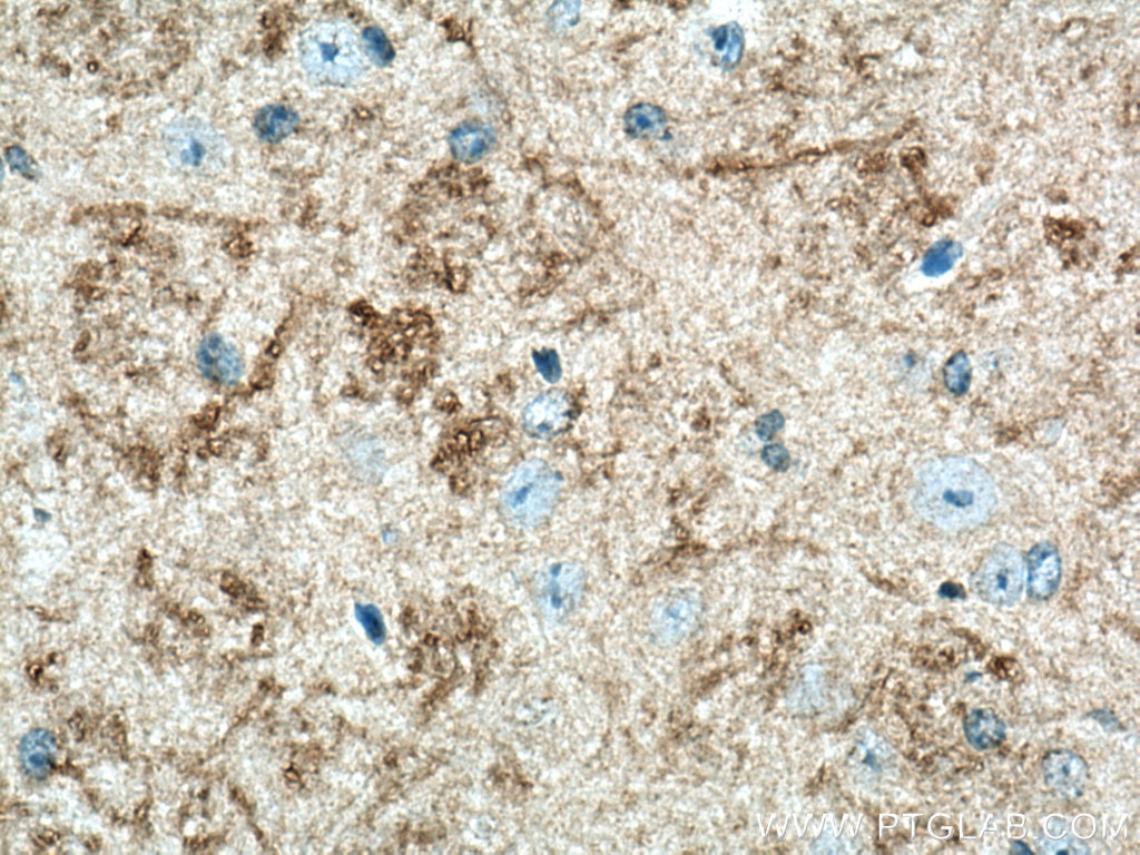 Immunohistochemistry (IHC) staining of mouse brain tissue using ARHGAP32 Polyclonal antibody (15024-1-AP)