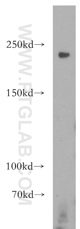 Western Blot (WB) analysis of HEK-293 cells using RICTOR Polyclonal antibody (12901-1-AP)