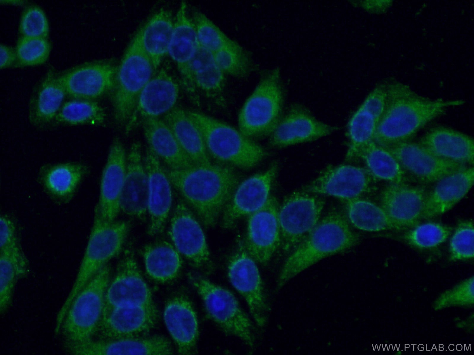 Immunofluorescence (IF) / fluorescent staining of HeLa cells using RICTOR Polyclonal antibody (27248-1-AP)