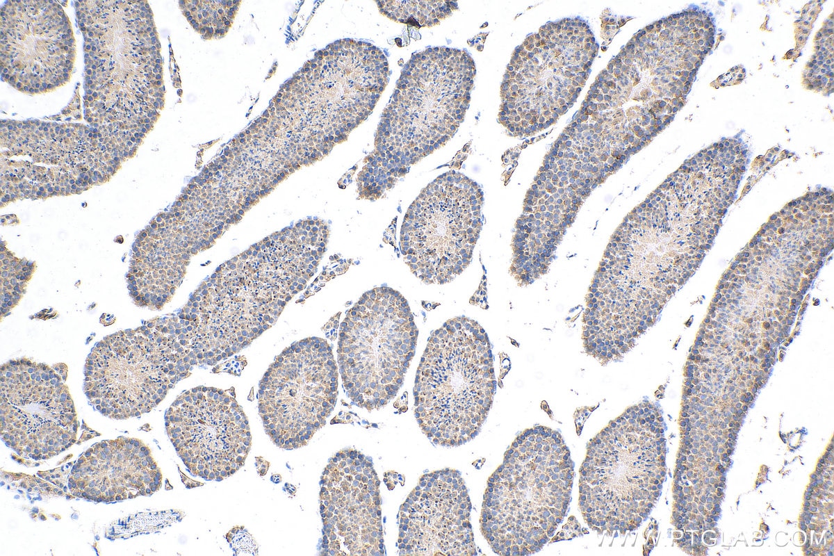 Immunohistochemistry (IHC) staining of mouse testis tissue using RICTOR Polyclonal antibody (27248-1-AP)