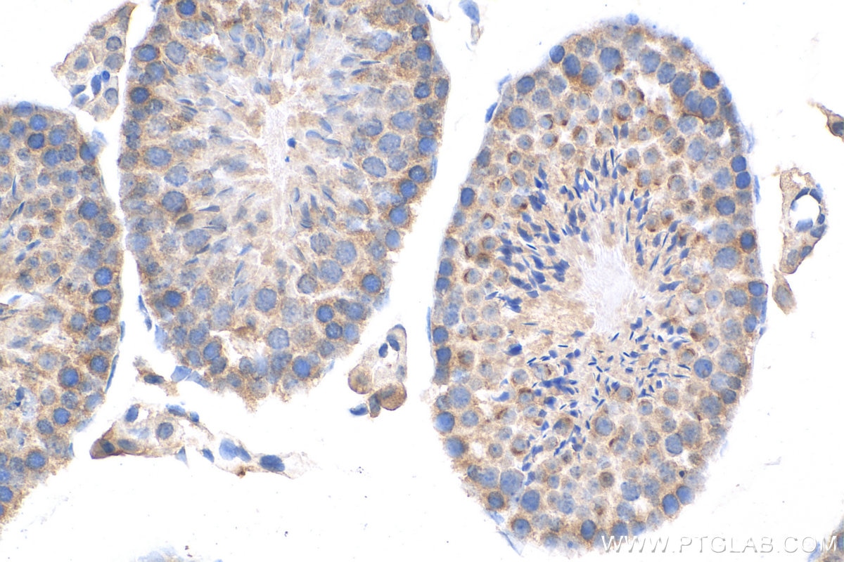 IHC staining of mouse testis using 27248-1-AP