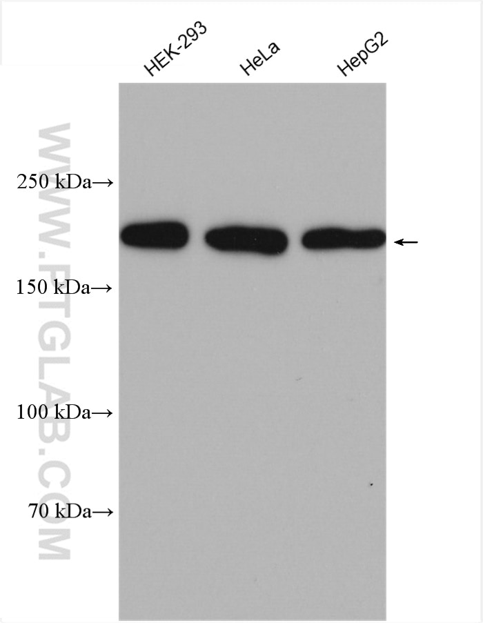 Western Blot (WB) analysis of various lysates using RICTOR Polyclonal antibody (27248-1-AP)