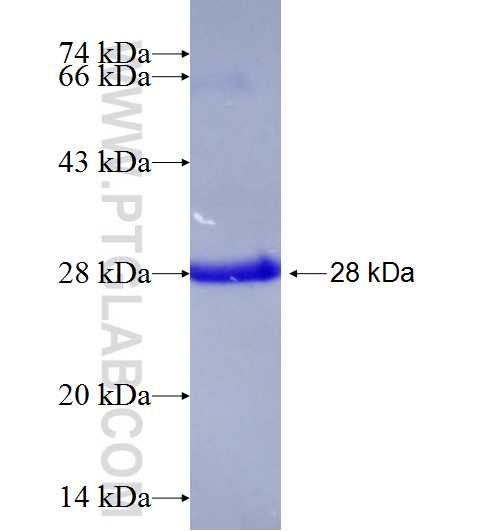 RICTOR fusion protein Ag25248 SDS-PAGE