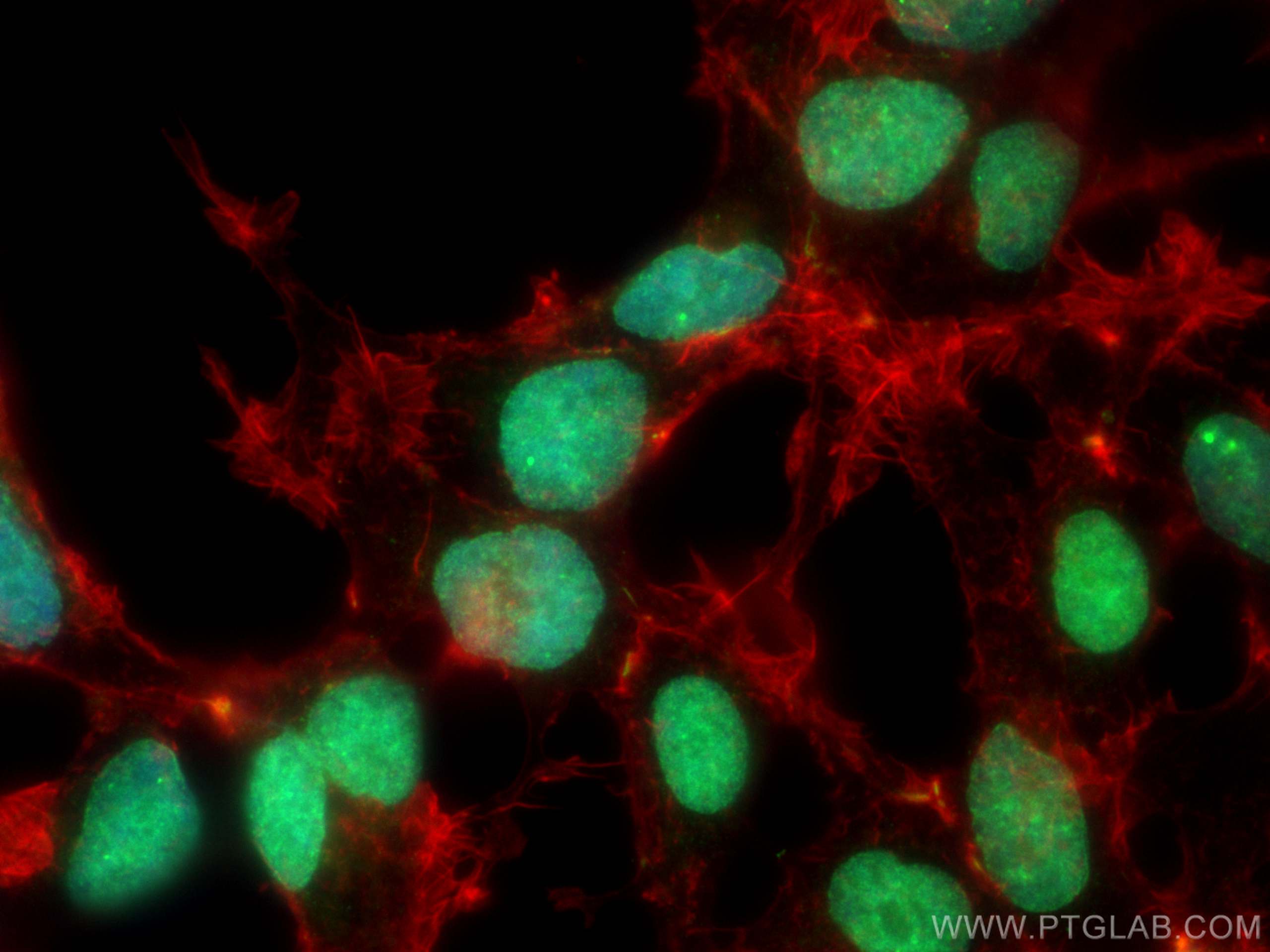 Immunofluorescence (IF) / fluorescent staining of HEK-293 cells using RIF1 Polyclonal antibody (30119-1-AP)
