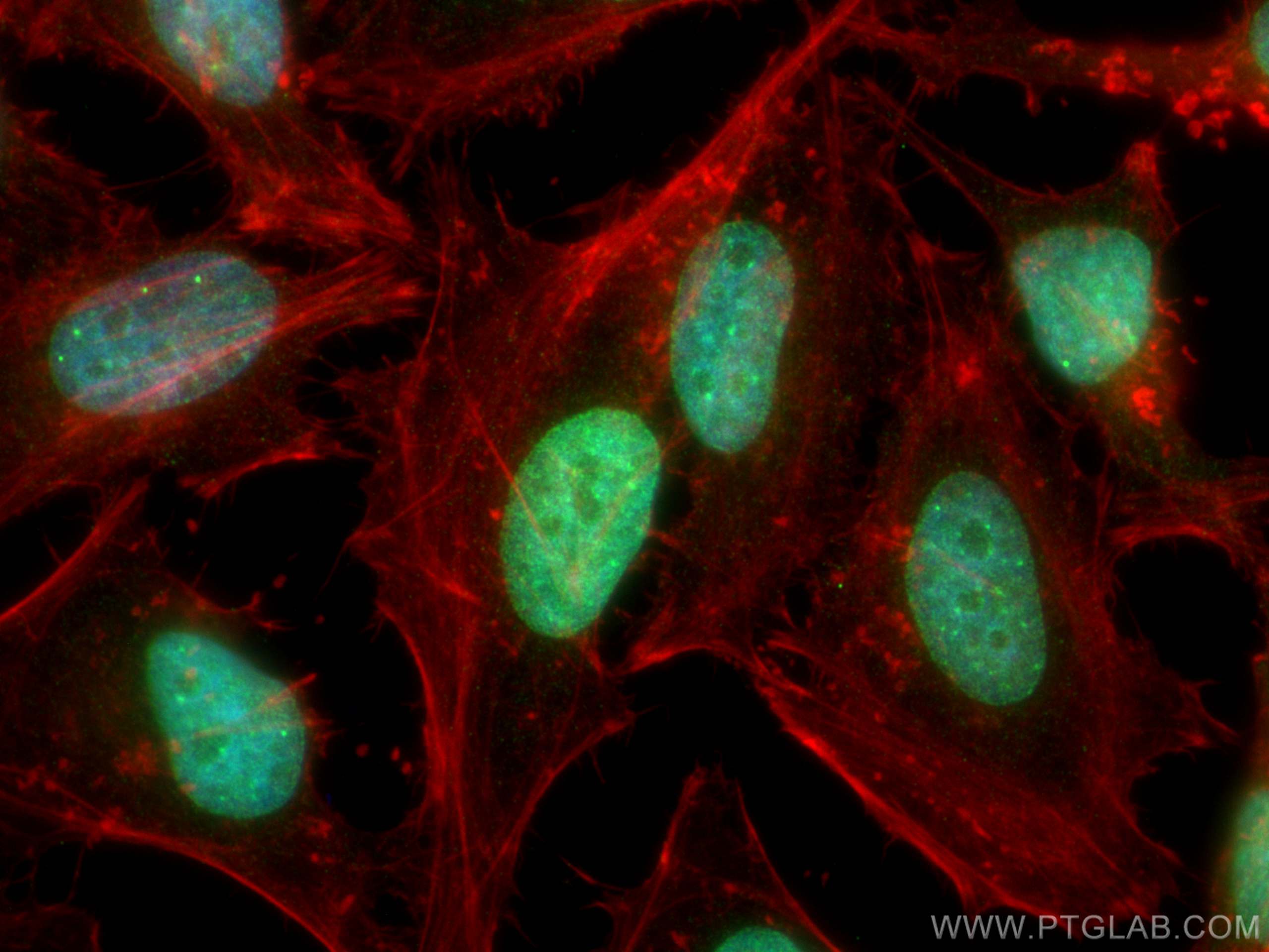 Immunofluorescence (IF) / fluorescent staining of HeLa cells using RIF1 Polyclonal antibody (30119-1-AP)