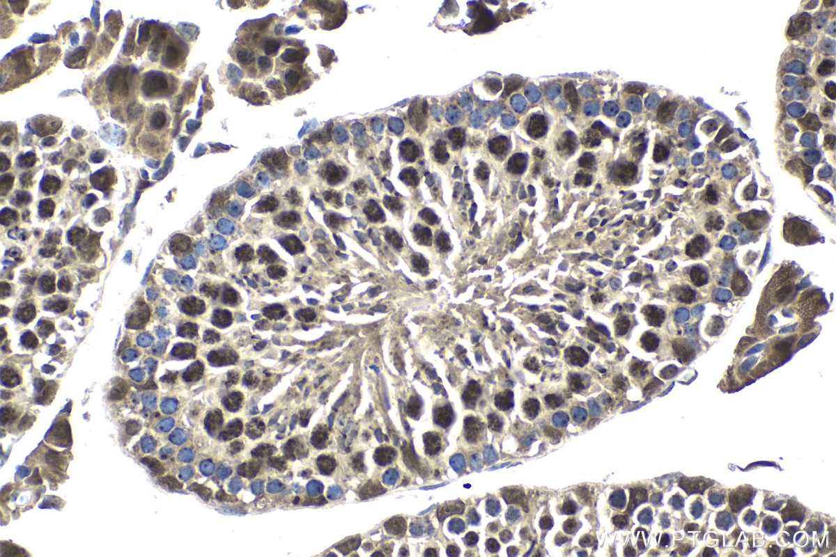 IHC staining of mouse testis using 30119-1-AP