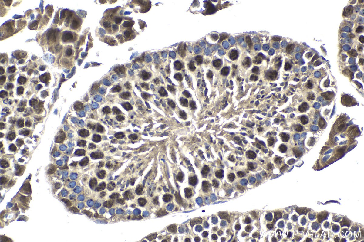 Immunohistochemistry (IHC) staining of mouse testis tissue using RIF1 Polyclonal antibody (30119-1-AP)