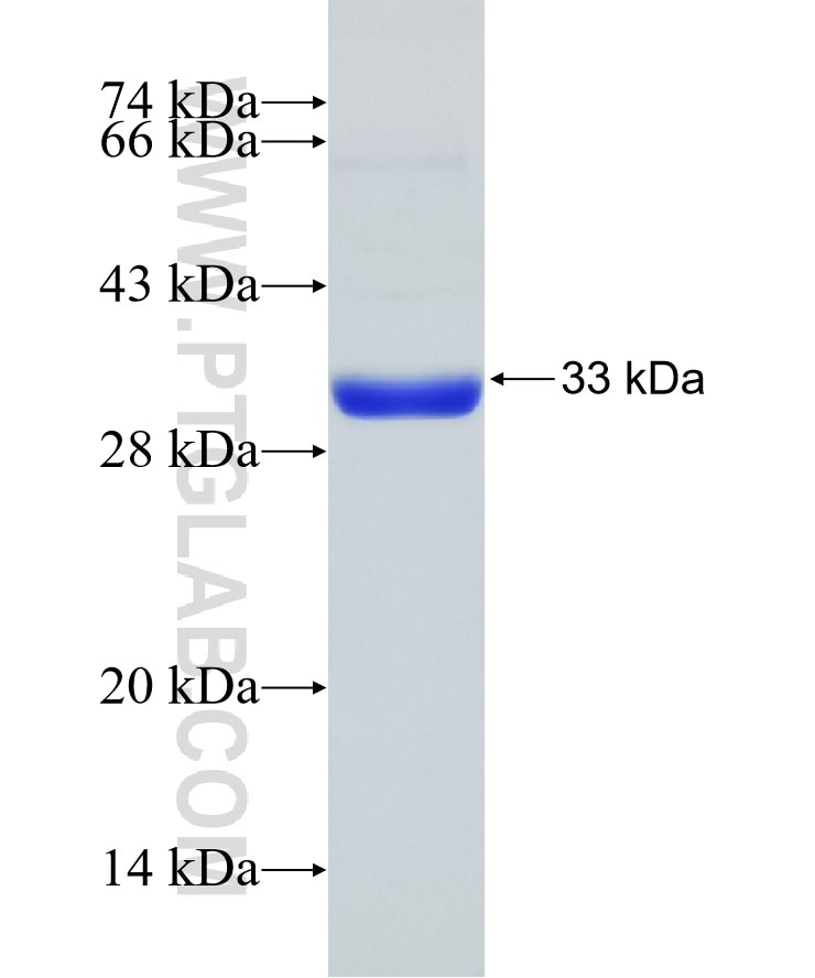 RIF1 fusion protein Ag32396 SDS-PAGE