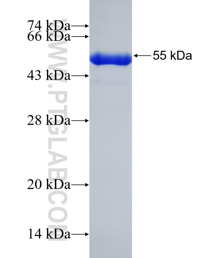 RIF1 fusion protein Ag32422 SDS-PAGE