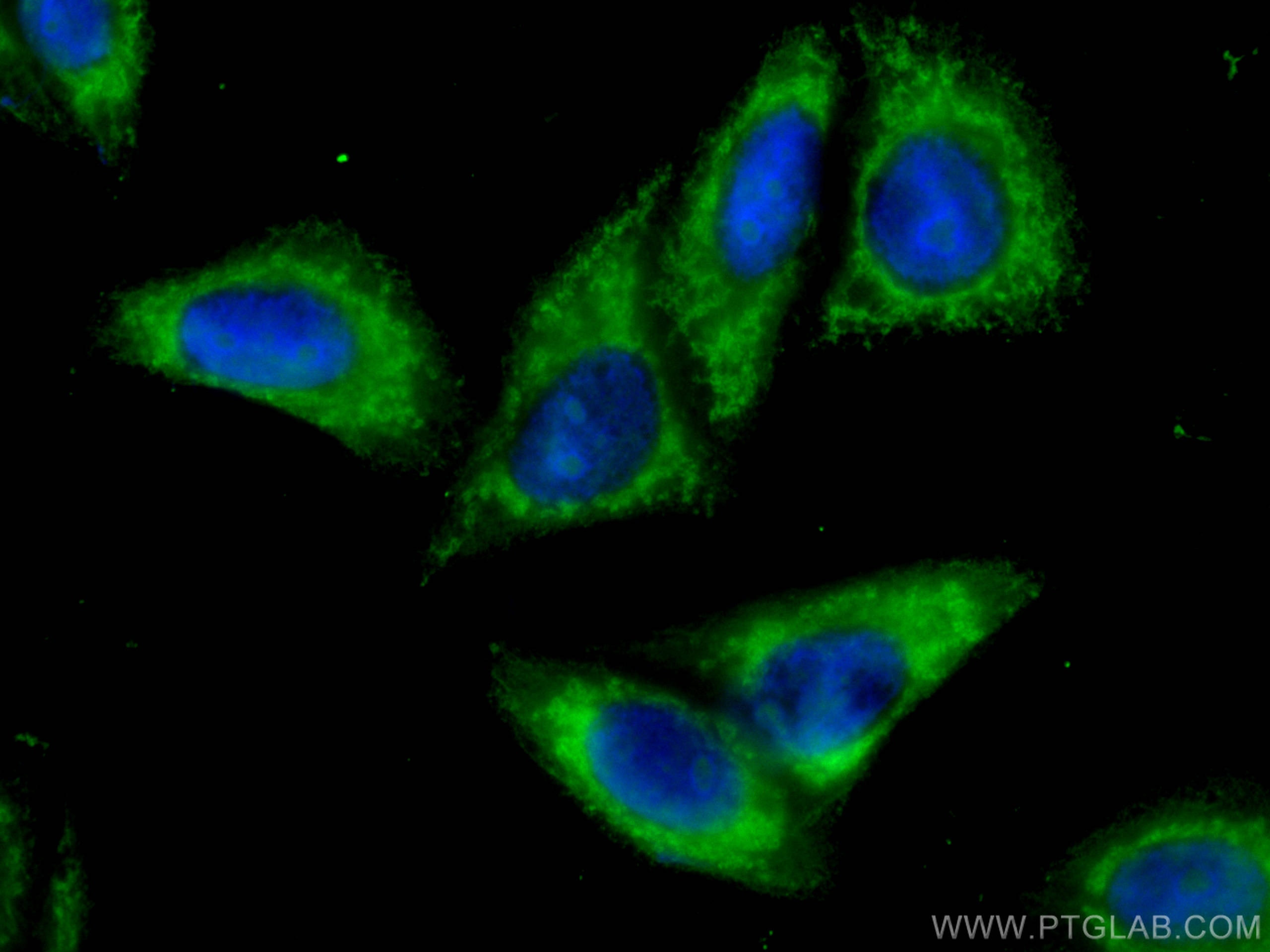 Immunofluorescence (IF) / fluorescent staining of HepG2 cells using CoraLite® Plus 488-conjugated RIG-1/DDX58 Monoclon (CL488-67556)