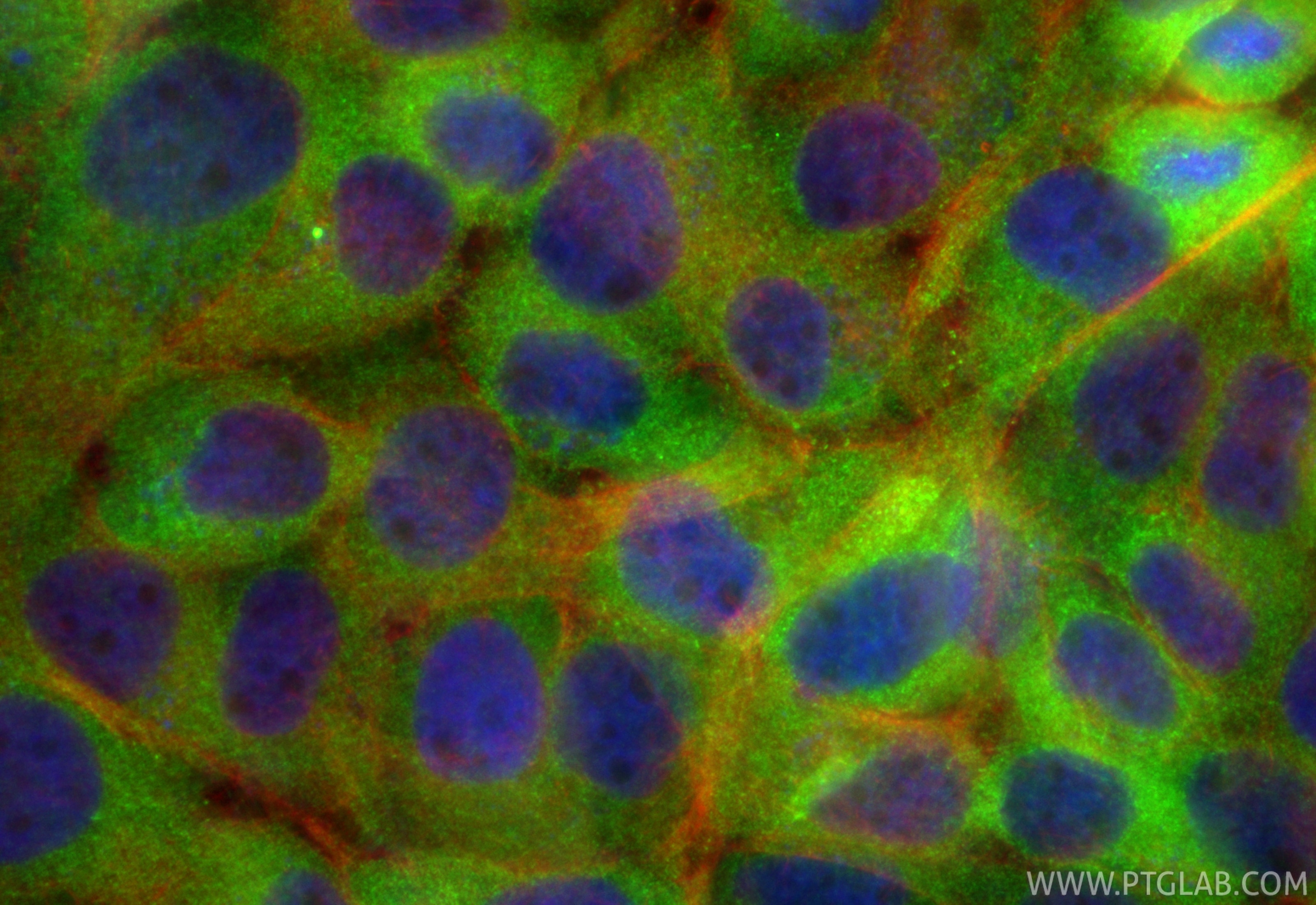 Immunofluorescent analysis of (4% PFA) fixed A431 cells using CoraLite® Plus 488 RIG-1/DDX58 antibody (CL488-84861-5, Clone: 242424E7 ) at dilution of 1:200, CL594-Phalloidin (red). Immunofluorescence (IF) / fluorescent staining of A431 cells using CoraLite® Plus 488-conjugated RIG-1/DDX58 Recombin (CL488-84861-5)