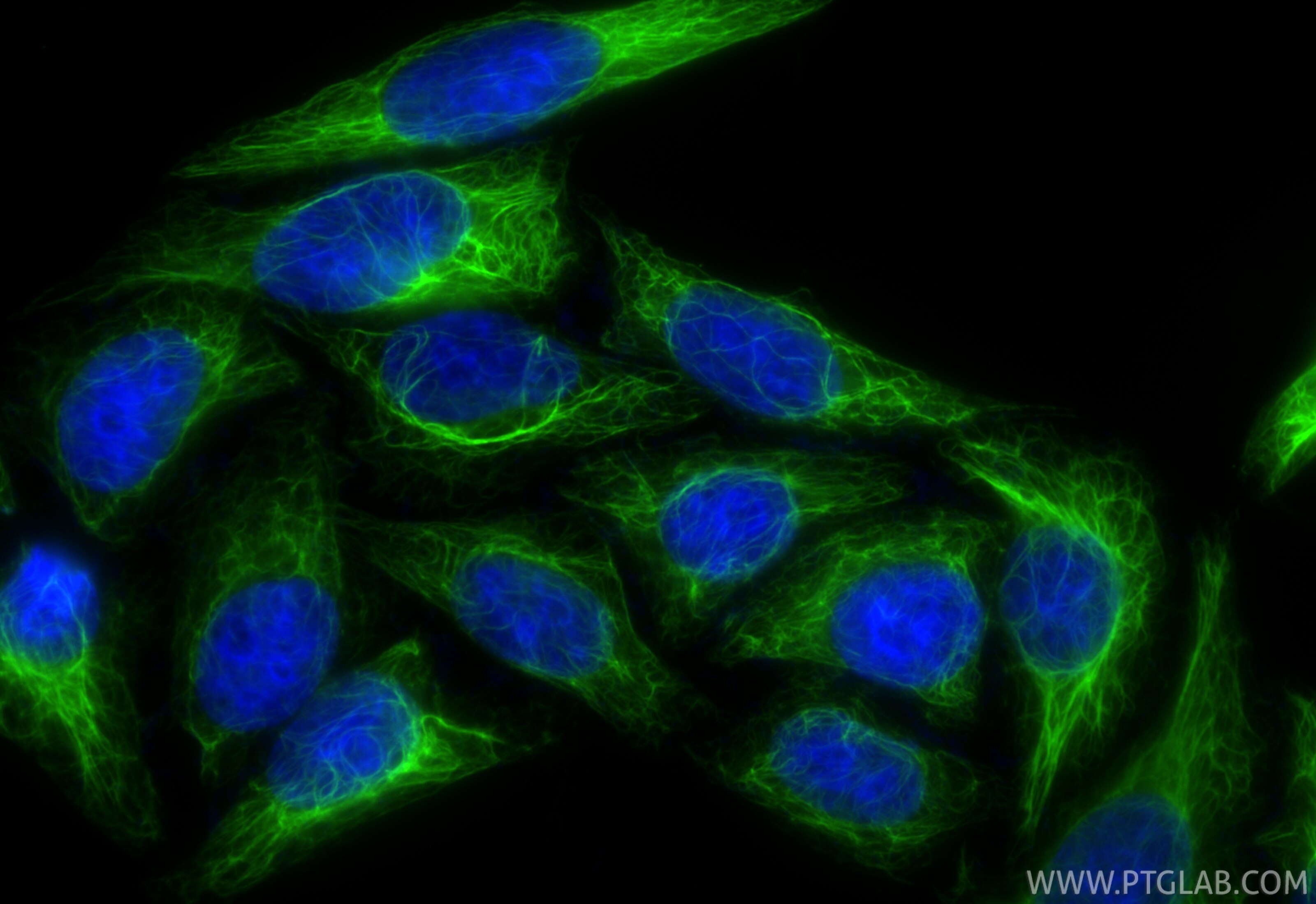 Immunofluorescent analysis of (-20°C Ethanol) fixed HepG2 cells using CoraLite® Plus 488 RIG-1/DDX58 antibody (CL488-84861-5, Clone: 242424E7 ) at dilution of 1:200. Immunofluorescence (IF) / fluorescent staining of HepG2 cells using CoraLite® Plus 488-conjugated RIG-1/DDX58 Recombin (CL488-84861-5)