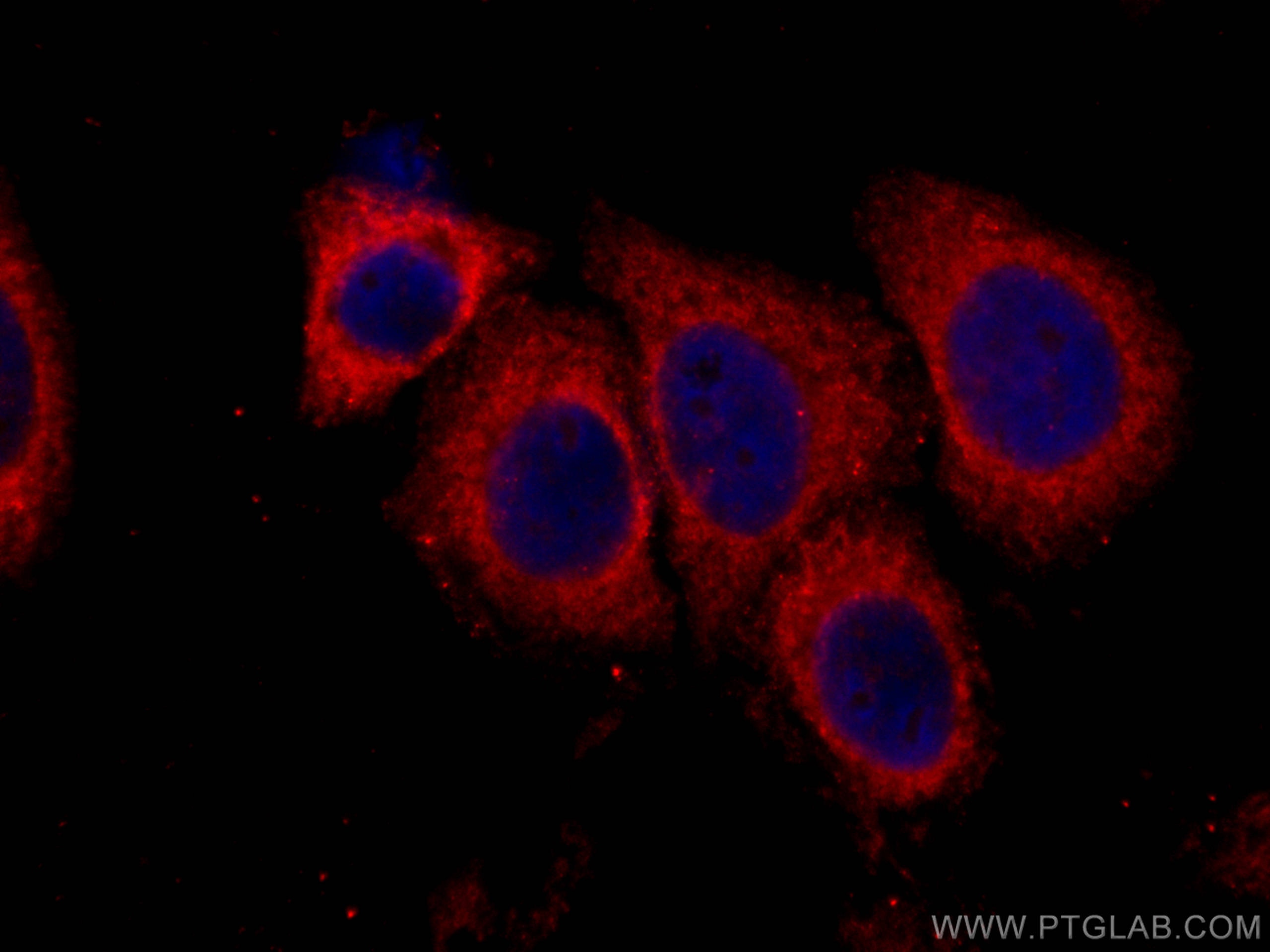 Immunofluorescence (IF) / fluorescent staining of HepG2 cells using CoraLite®594-conjugated RIG-1/DDX58 Monoclonal ant (CL594-67556)