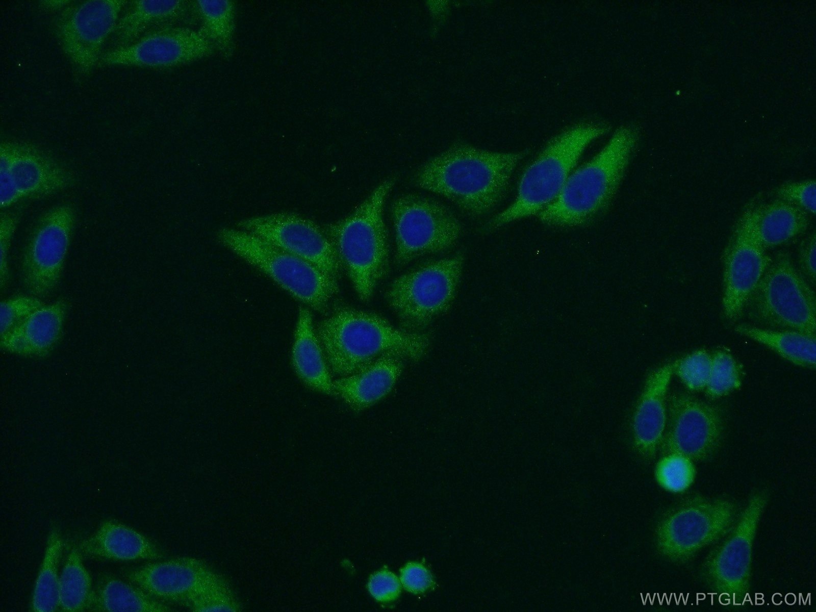 Immunofluorescence (IF) / fluorescent staining of HepG2 cells using RILP Polyclonal antibody (13574-1-AP)