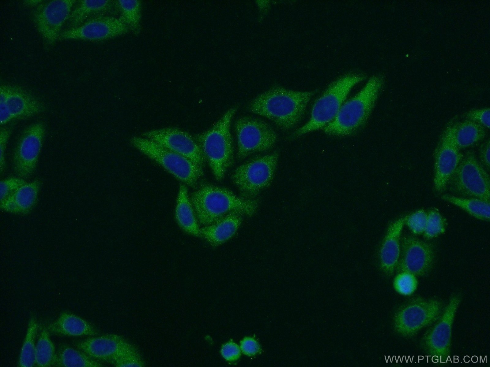 IF Staining of HepG2 using 13574-1-AP