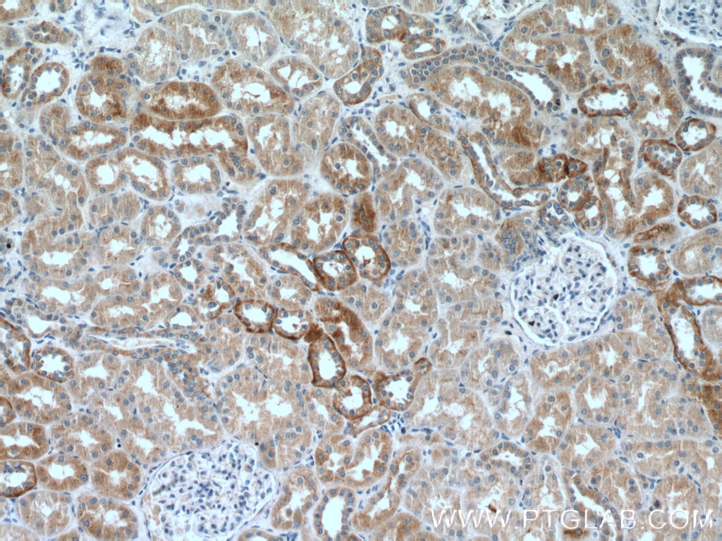 Immunohistochemistry (IHC) staining of human kidney tissue using RILP Polyclonal antibody (13574-1-AP)