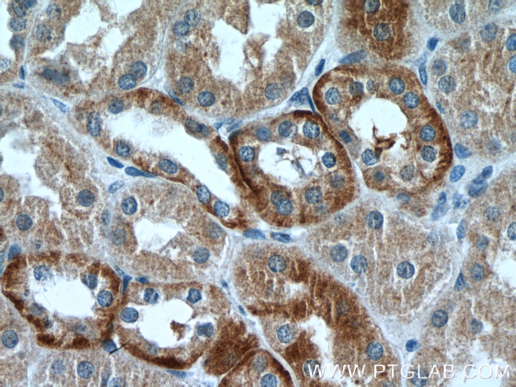 Immunohistochemistry (IHC) staining of human kidney tissue using RILP Polyclonal antibody (13574-1-AP)