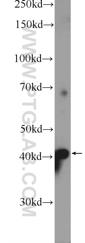 Western Blot (WB) analysis of HepG2 cells using RILP Polyclonal antibody (13574-1-AP)