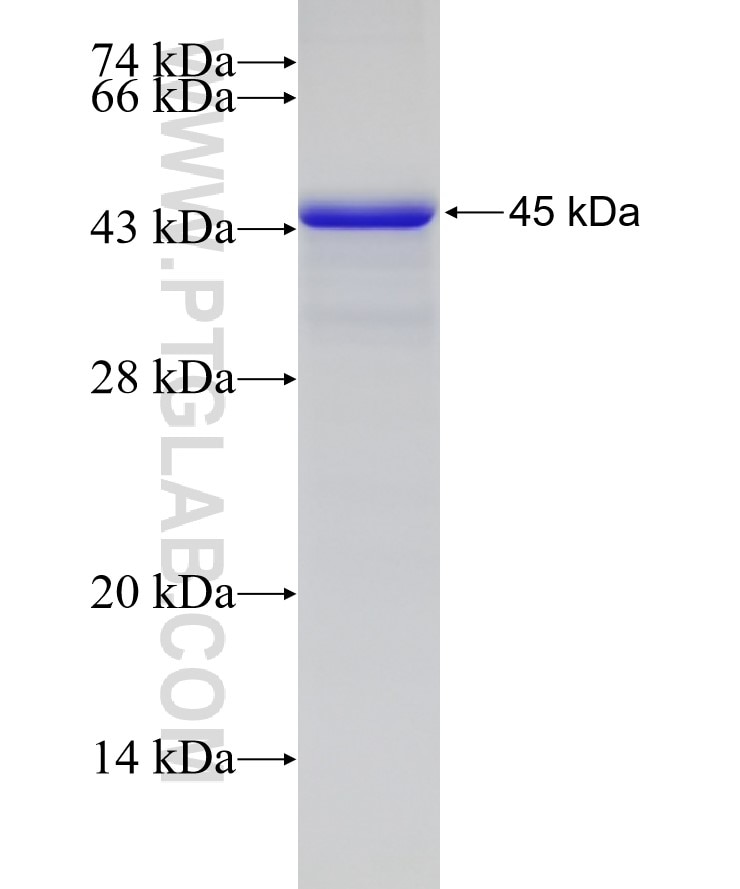 RILP fusion protein Ag4472 SDS-PAGE