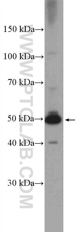 Western Blot (WB) analysis of HeLa cells using RILPL1 Polyclonal antibody (16732-1-AP)