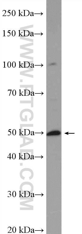 Western Blot (WB) analysis of HeLa cells using RILPL1 Polyclonal antibody (16732-1-AP)