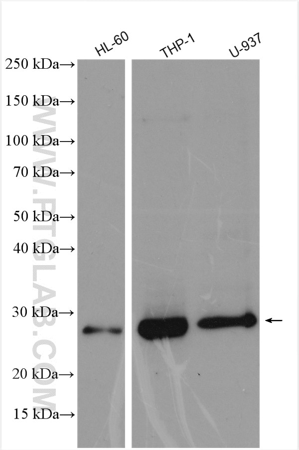 Western Blot (WB) analysis of various lysates using RILPL2 Polyclonal antibody (15955-1-AP)