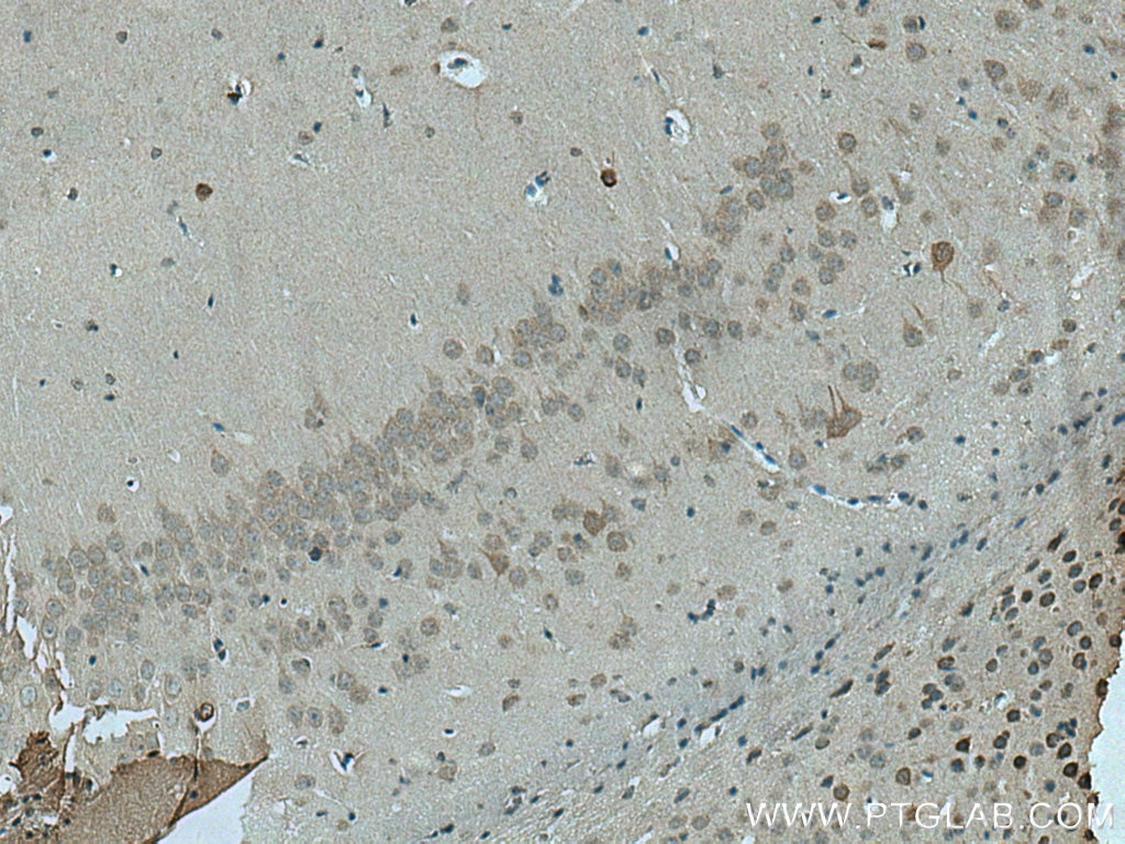 Immunohistochemistry (IHC) staining of mouse brain tissue using RIMBP2 Polyclonal antibody (15716-1-AP)