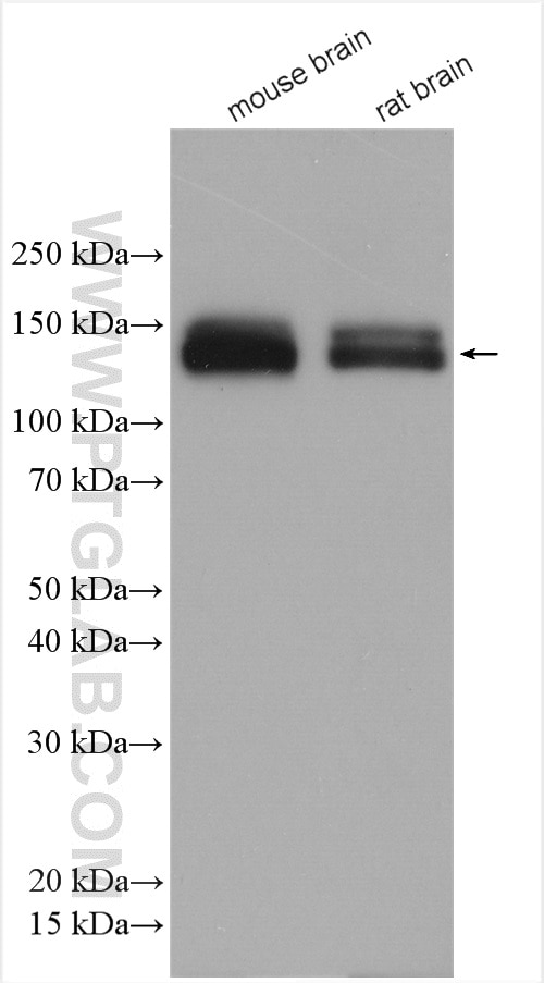 Western Blot (WB) analysis of various lysates using RIMBP2 Polyclonal antibody (15716-1-AP)