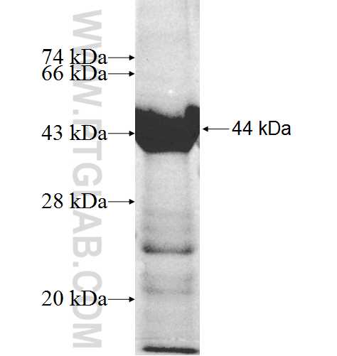 RIMBP2 fusion protein Ag8373 SDS-PAGE