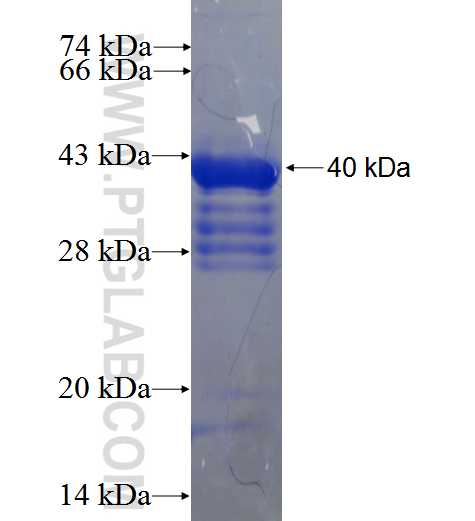 RIMKLA fusion protein Ag23687 SDS-PAGE RIMKLA fusion protein Ag23687 SDS-PAGE