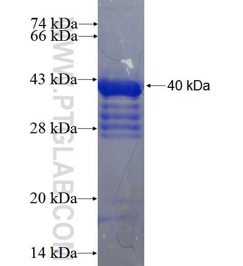 RIMKLA fusion protein Ag23687 SDS-PAGE