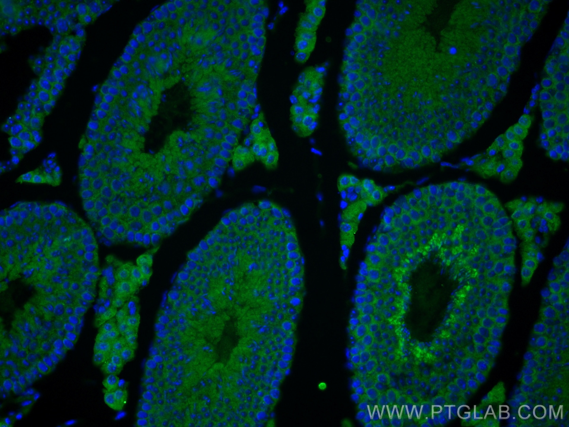 Immunofluorescence (IF) / fluorescent staining of mouse testis tissue using RIMKLB Polyclonal antibody (26111-1-AP)