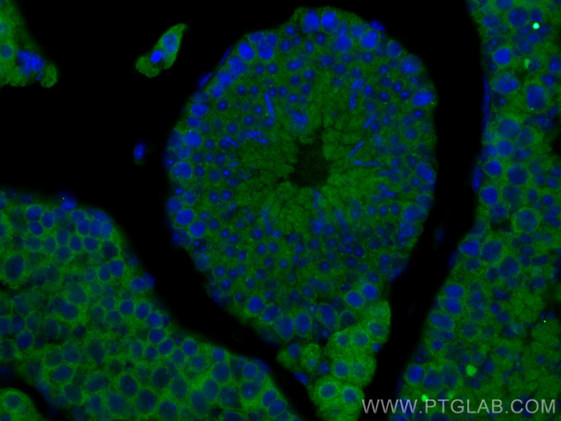 Immunofluorescence (IF) / fluorescent staining of mouse testis tissue using RIMKLB Polyclonal antibody (26111-1-AP)