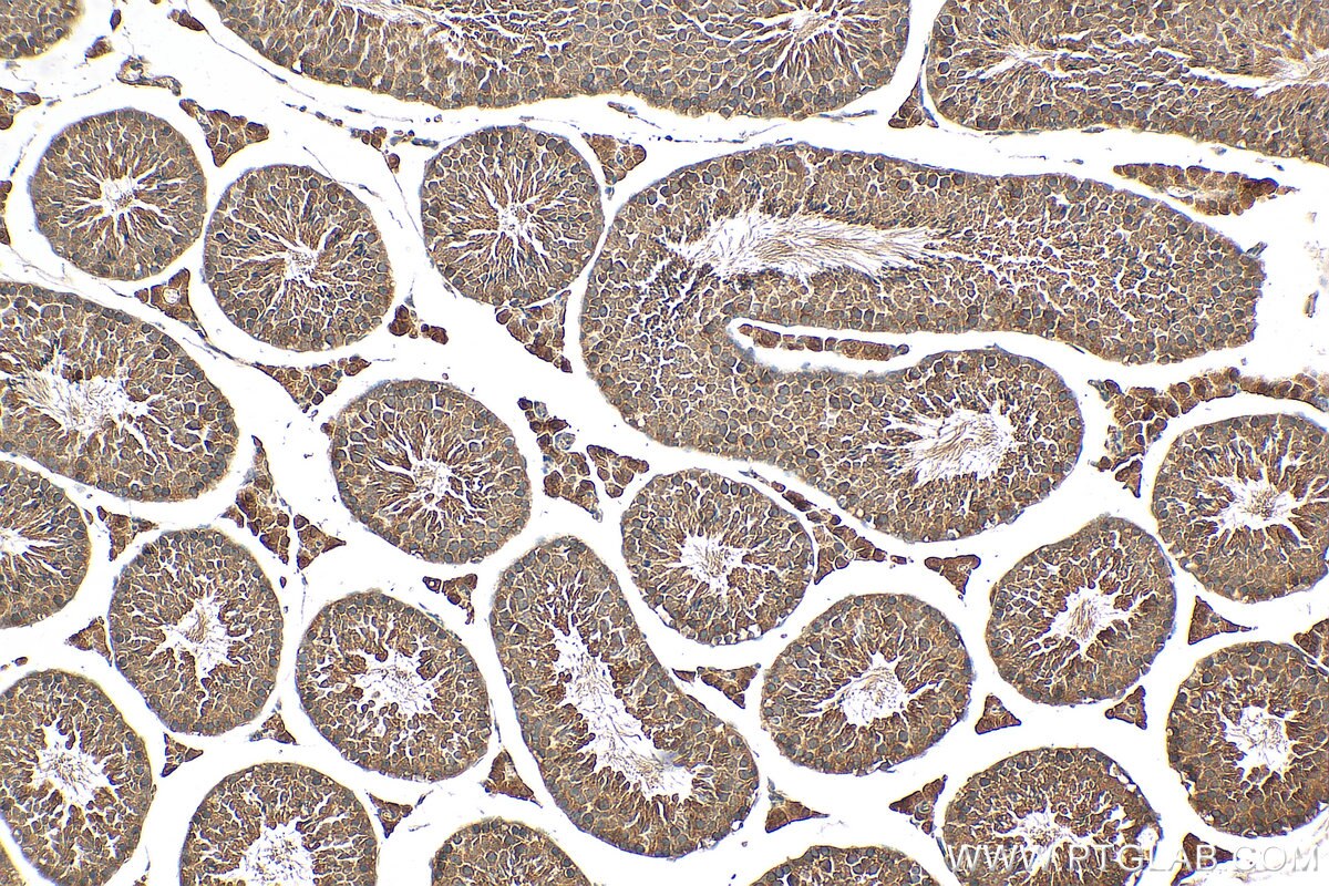 Immunohistochemistry (IHC) staining of mouse testis tissue using RIMKLB Polyclonal antibody (26111-1-AP)