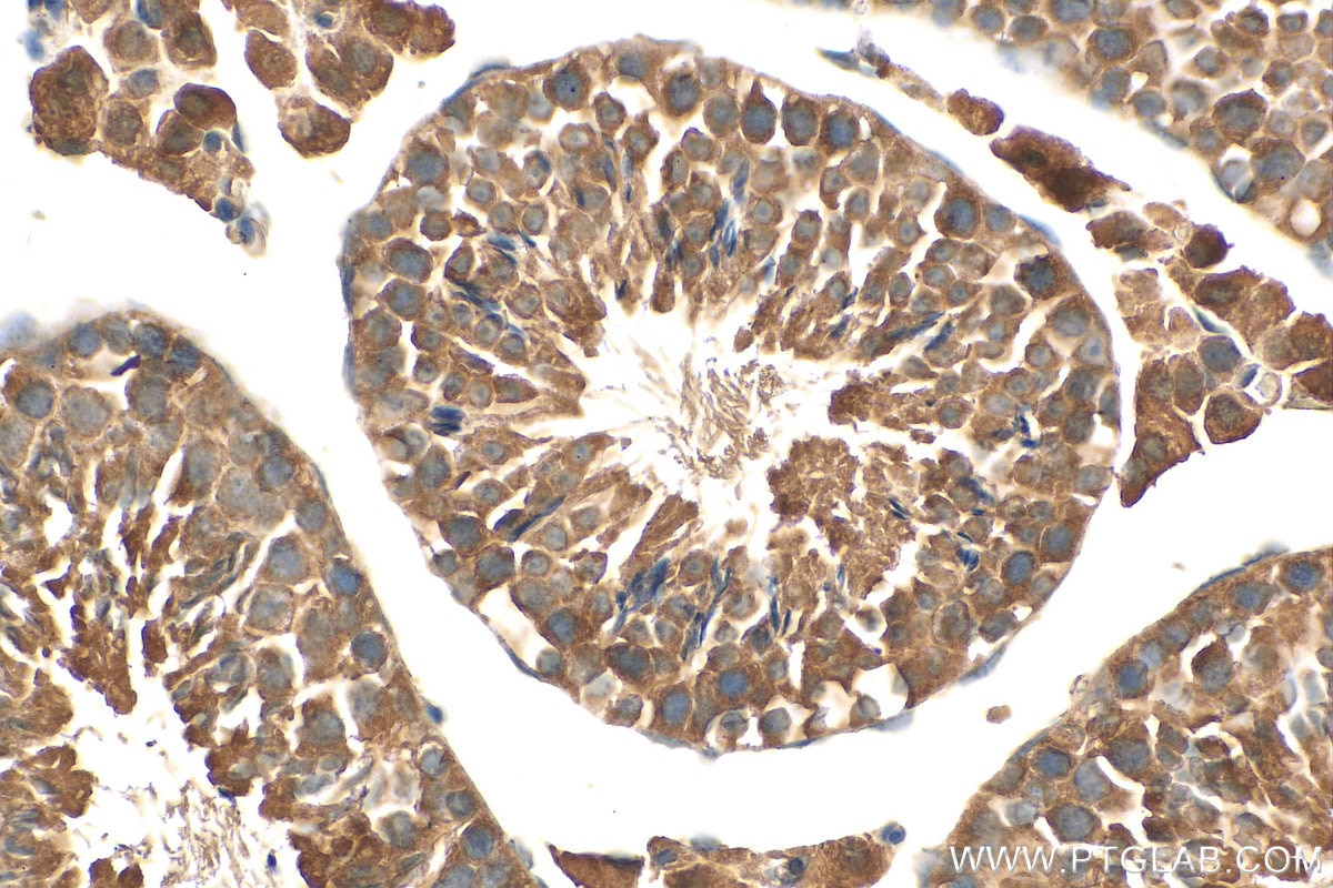 Immunohistochemistry (IHC) staining of mouse testis tissue using RIMKLB Polyclonal antibody (26111-1-AP)