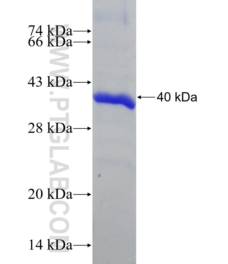 RIMKLB fusion protein Ag23631 SDS-PAGE