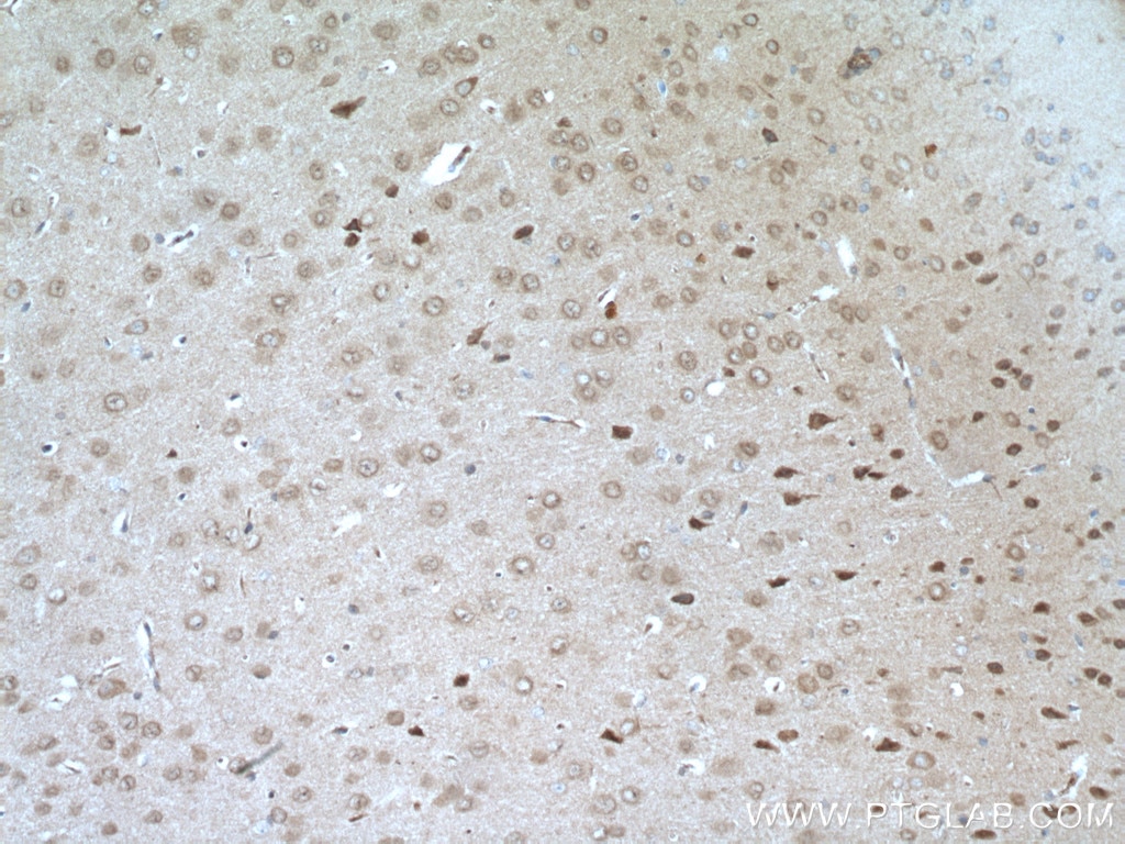 Immunohistochemistry (IHC) staining of mouse brain tissue using RIM1 Polyclonal antibody (24576-1-AP)