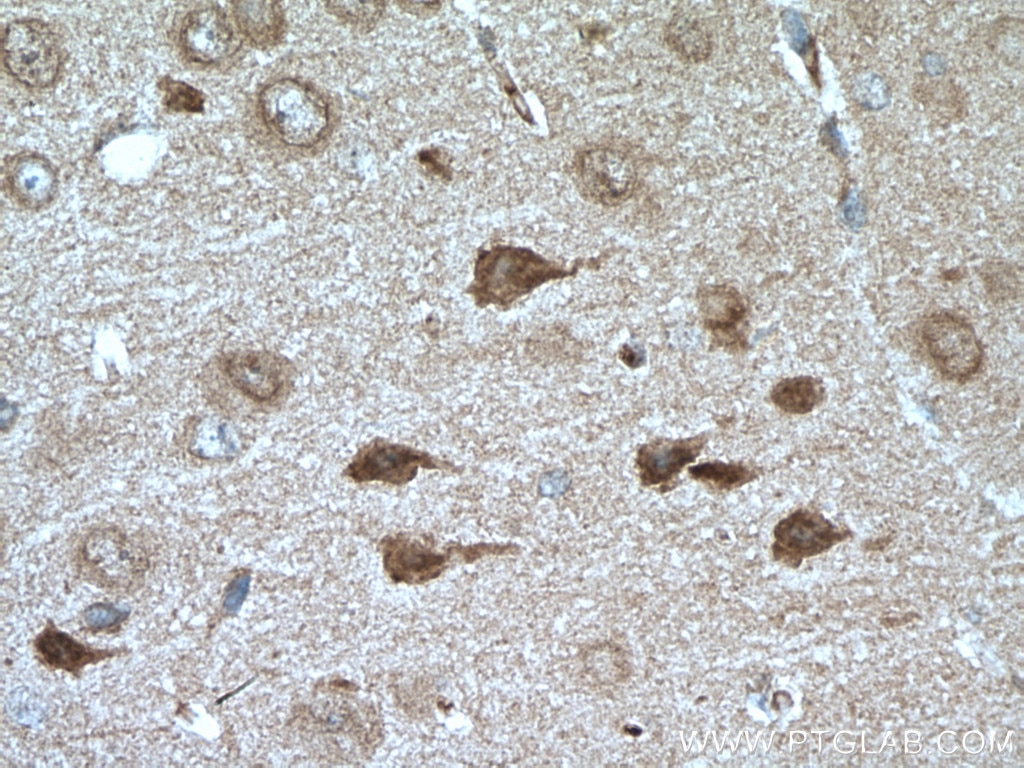 Immunohistochemistry (IHC) staining of mouse brain tissue using RIM1 Polyclonal antibody (24576-1-AP)