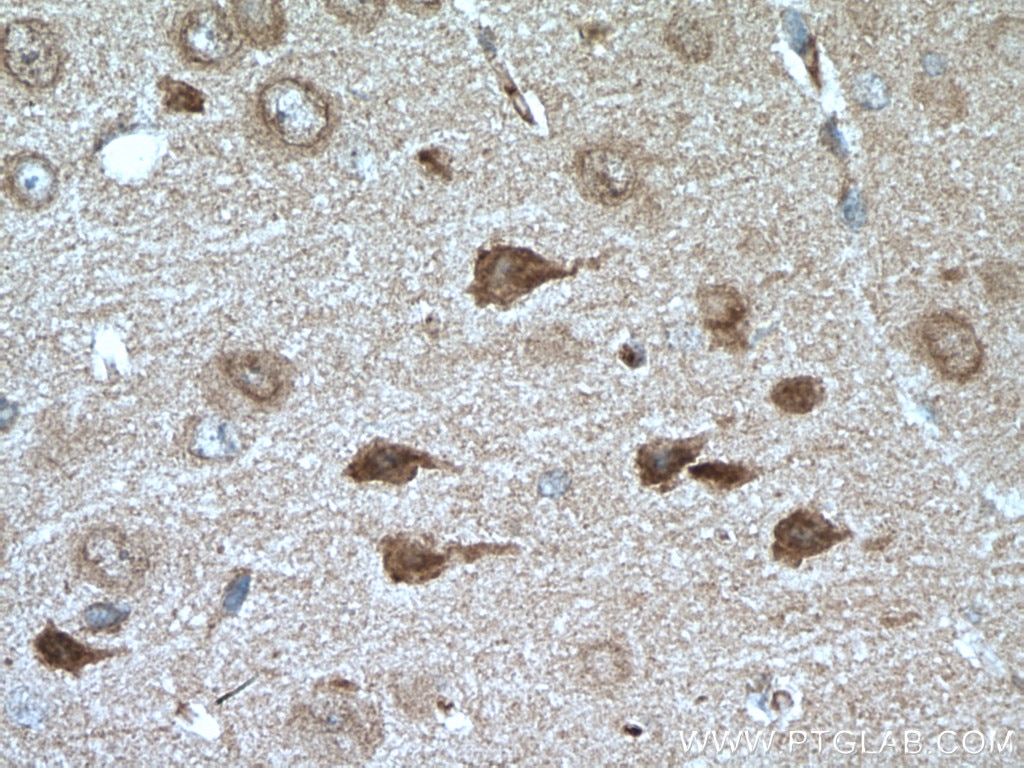 IHC staining of mouse brain using 24576-1-AP