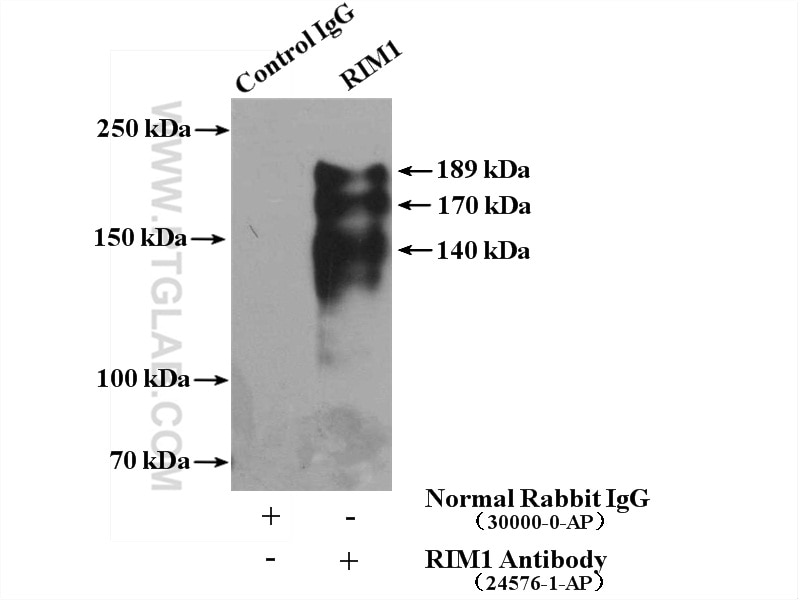 Immunoprecipitation (IP) experiment of mouse brain tissue using RIM1 Polyclonal antibody (24576-1-AP)