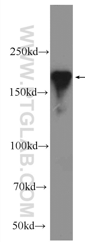 Western Blot (WB) analysis of rat brain tissue using RIM1 Polyclonal antibody (24576-1-AP)