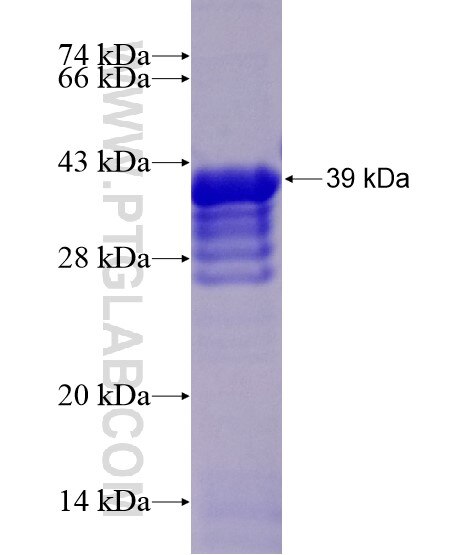 RIMS1 fusion protein Ag20161 SDS-PAGE